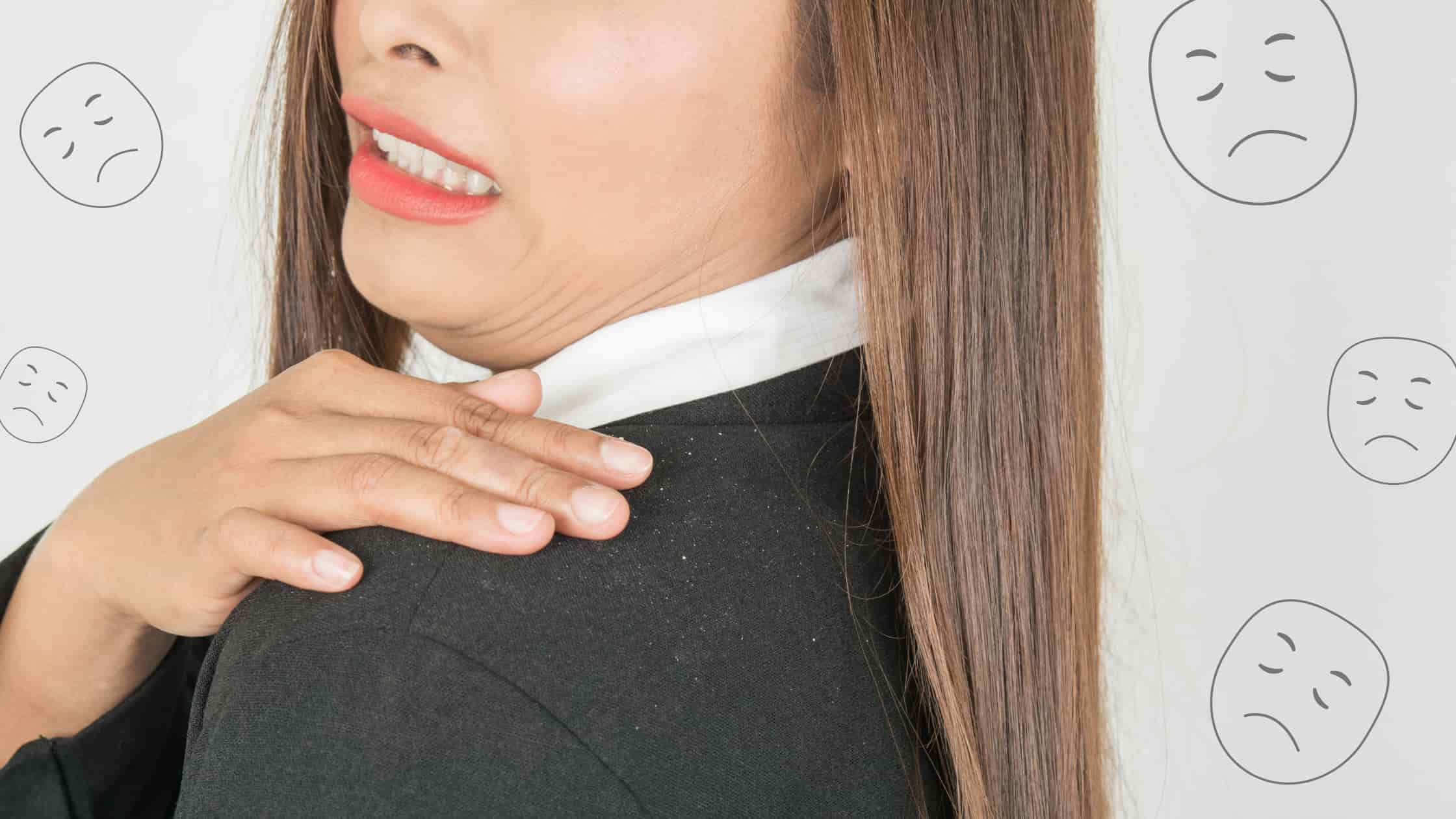woman having dandruff fall off her shoulders
